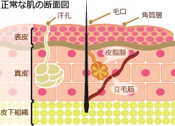 ニキビの種類と治療